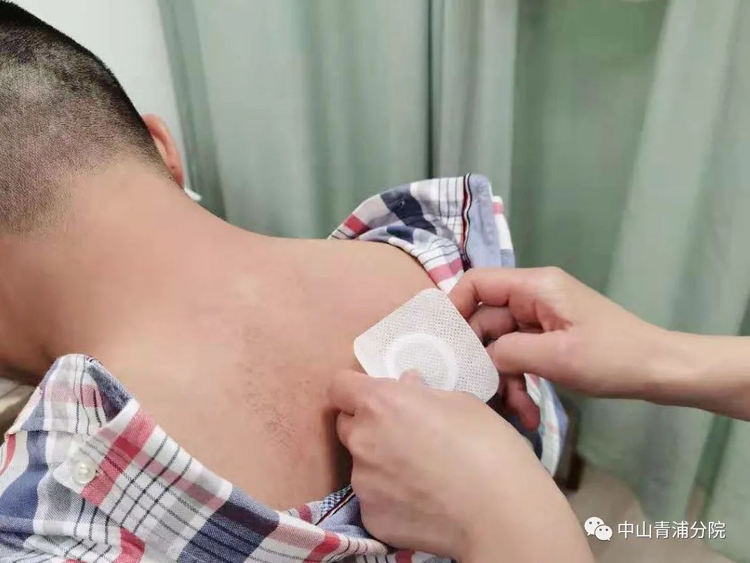 2、江西兒童貼三伏貼癢灼痛，什么體質(zhì)的人可以貼三伏貼癢灼痛？